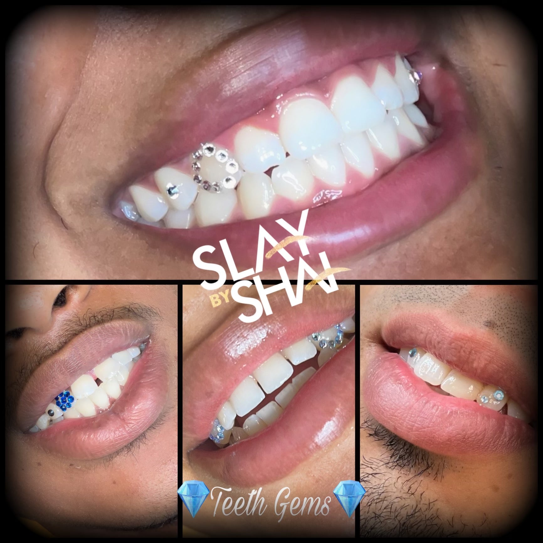 Tooth Gem - Main Image